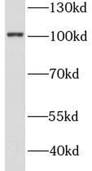 STT3A Rabbit Polyclonal Antibody