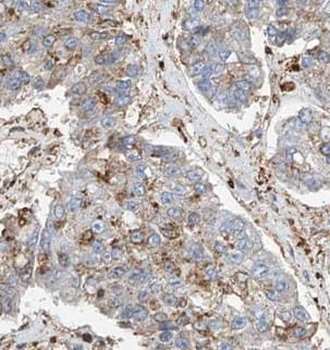 STT3A Rabbit Polyclonal Antibody