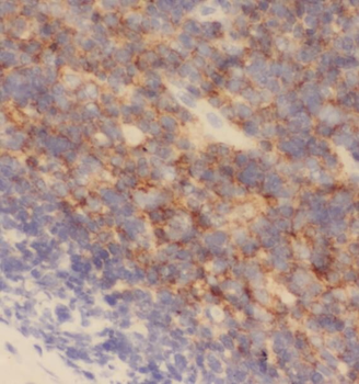 STXBP3 Rabbit Polyclonal Antibody