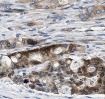 STXBP4 Rabbit Polyclonal Antibody