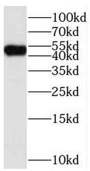 STYK1 Rabbit Polyclonal Antibody