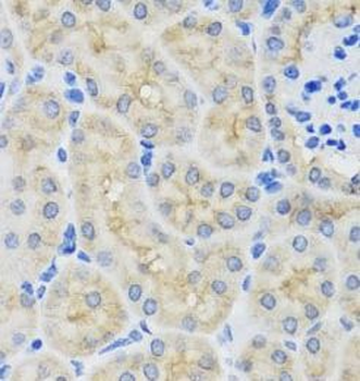 SULT1A1 Rabbit Polyclonal Antibody