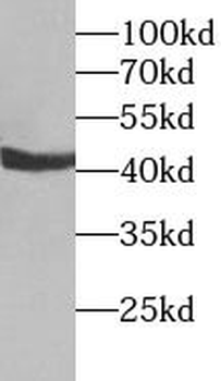 SULT2B1 Rabbit Polyclonal Antibody