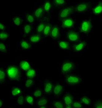 SULT2B1 Rabbit Polyclonal Antibody