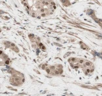 SULT2B1 Rabbit Polyclonal Antibody