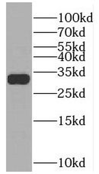 SULT4A1 Rabbit Polyclonal Antibody