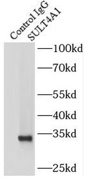 SULT4A1 Rabbit Polyclonal Antibody