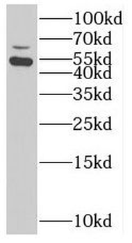 SUOX Rabbit Polyclonal Antibody