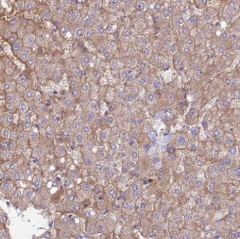 SUOX Rabbit Polyclonal Antibody