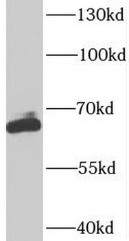 SUPT7L Rabbit Polyclonal Antibody