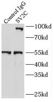 SUZ12 Rabbit Polyclonal Antibody