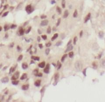 SUZ12 Rabbit Polyclonal Antibody