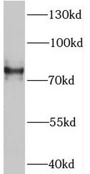 SV2B Rabbit Polyclonal Antibody