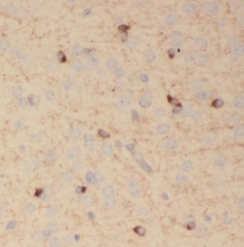 SV2B Rabbit Polyclonal Antibody