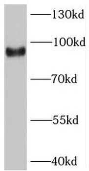 SV2C Rabbit Polyclonal Antibody