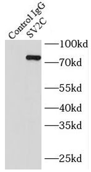 SV2C Rabbit Polyclonal Antibody