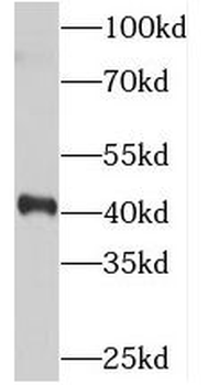 SYCE1 Rabbit Polyclonal Antibody