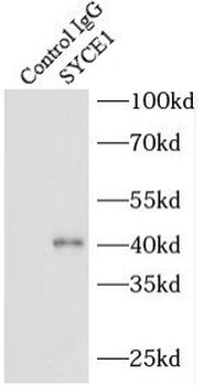 SYCE1 Rabbit Polyclonal Antibody