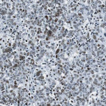 SYCE1 Rabbit Polyclonal Antibody