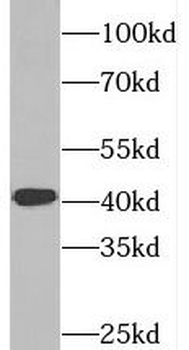 SYCE1 Rabbit Polyclonal Antibody