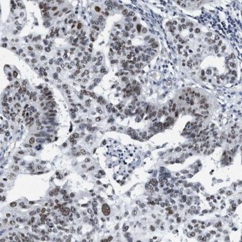 SYCE1 Rabbit Polyclonal Antibody