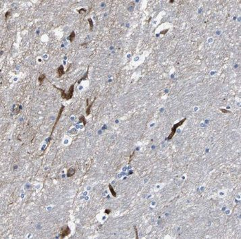 SYNGR2 Rabbit Polyclonal Antibody