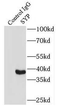 SYP Antibody
