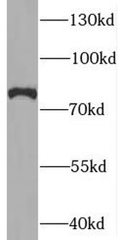 SYNPO2L Rabbit Polyclonal Antibody