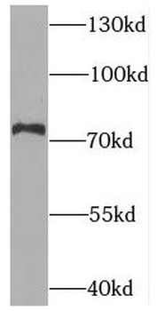 SNPH Rabbit Polyclonal Antibody