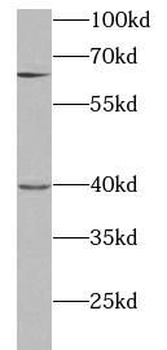 STX12 Rabbit Polyclonal Antibody