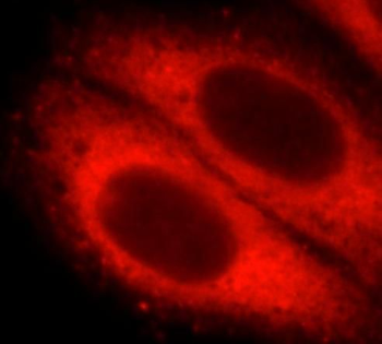 STX12 Rabbit Polyclonal Antibody