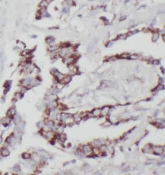 STX12 Rabbit Polyclonal Antibody