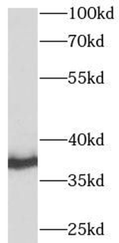 STX4 Rabbit Polyclonal Antibody