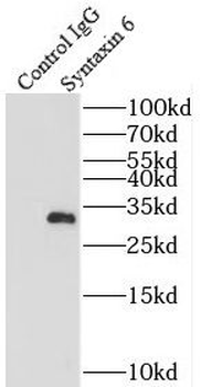 STX6 Rabbit Polyclonal Antibody