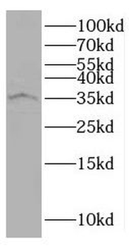 SDCBP2 Antibody
