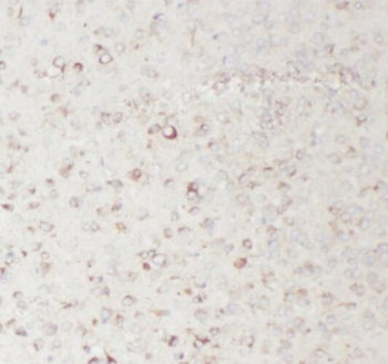 TAC1 Antibody