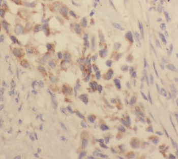 TACC2 Rabbit Polyclonal Antibody