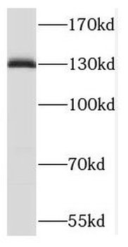 TACC3 Rabbit Polyclonal Antibody