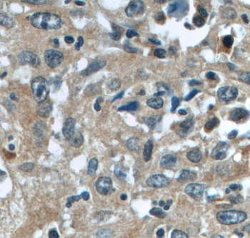 TACC3 Rabbit Polyclonal Antibody