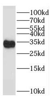 TACO1 Rabbit Polyclonal Antibody