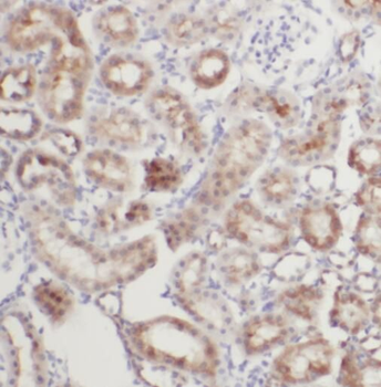 TACO1 Rabbit Polyclonal Antibody
