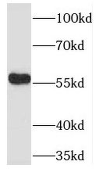 TADA2B Rabbit Polyclonal Antibody