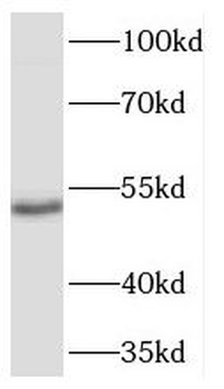 TADA2A Rabbit Polyclonal Antibody