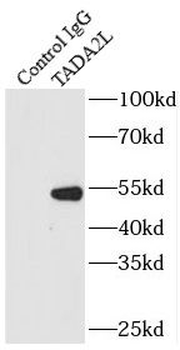 TADA2A Rabbit Polyclonal Antibody