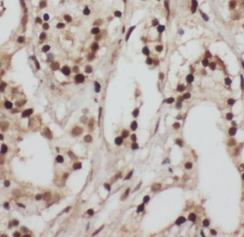TADA3 Antibody
