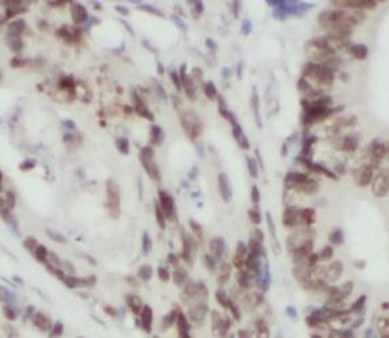 TAF15 Rabbit Polyclonal Antibody