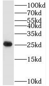 TAF9 Rabbit Polyclonal Antibody