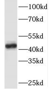 TAL1 Rabbit Polyclonal Antibody
