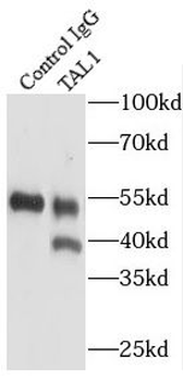 TAL1 Rabbit Polyclonal Antibody