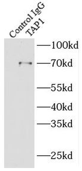 TAP1 Antibody